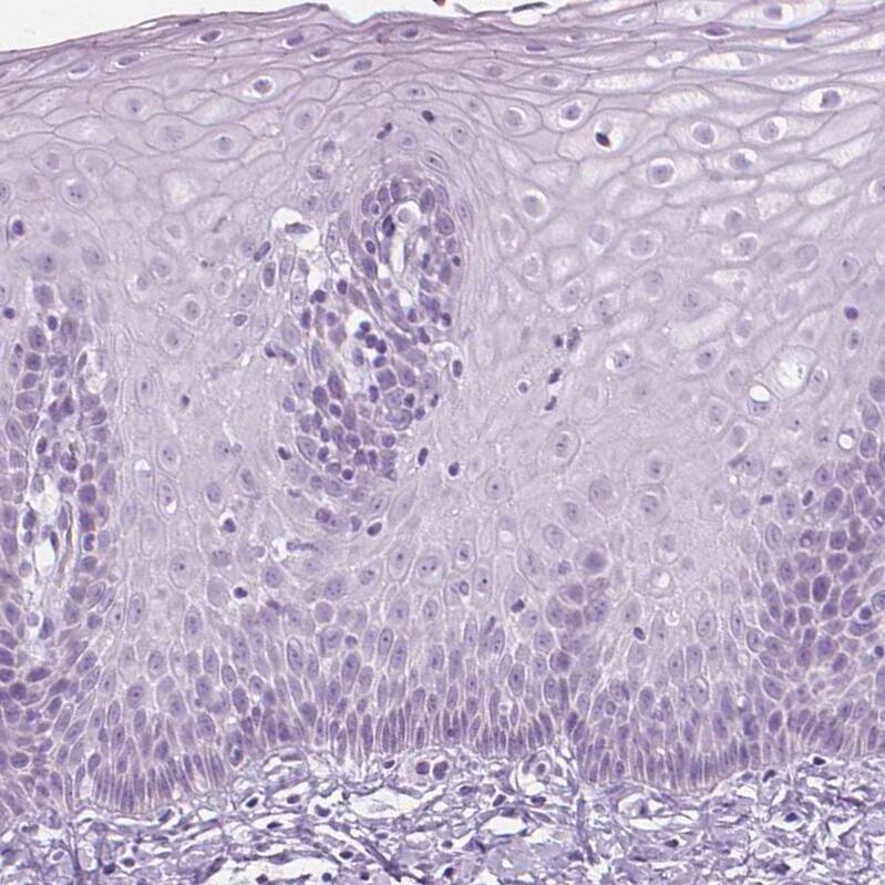 Secretogranin 3 Antibody - BSA Free Immunohistochemistry-Paraffin: Secretogranin 3 Antibody - BSA Free [NBP1-89825]