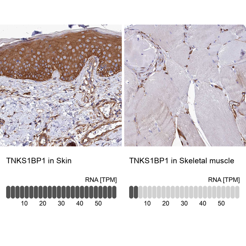 Tankyrase binding protein 1 Antibody - BSA Free Immunohistochemistry-Paraffin: Tankyrase binding protein 1 Antibody - BSA Free [NBP1-89826]