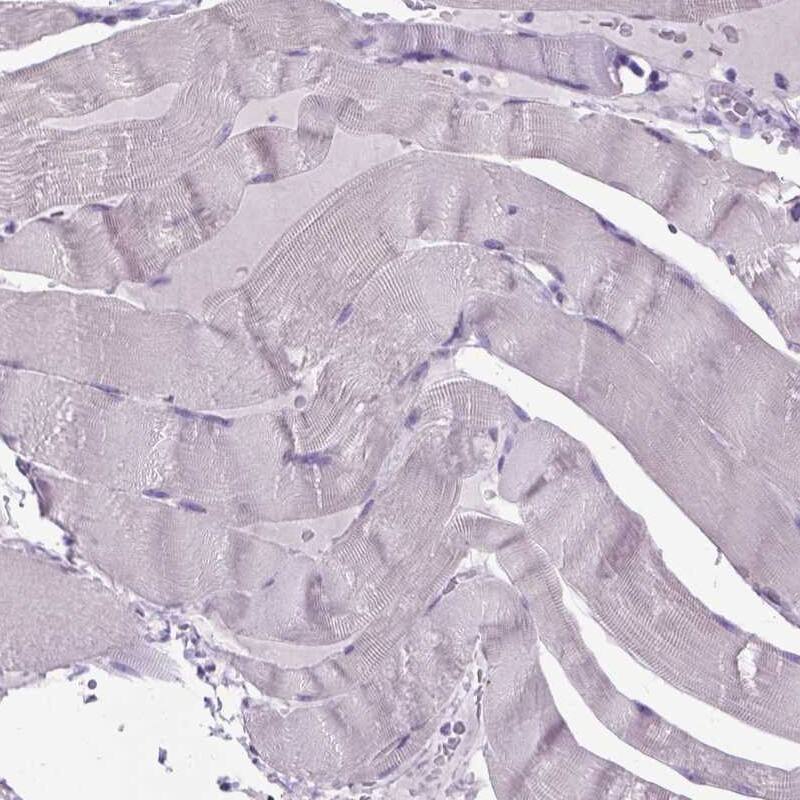 MARCH10 Antibody - BSA Free Immunohistochemistry-Paraffin: MARCH10 Antibody - BSA Free [NBP1-89833]