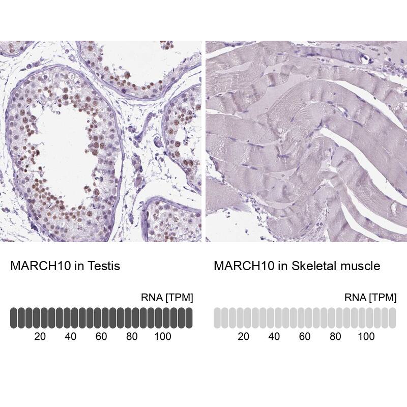 MARCH10 Antibody - BSA Free Immunohistochemistry-Paraffin: MARCH10 Antibody - BSA Free [NBP1-89833]
