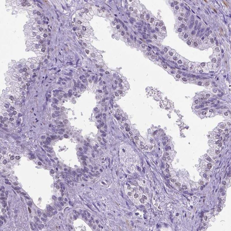 MARCH10 Antibody - BSA Free Immunohistochemistry-Paraffin: MARCH10 Antibody - BSA Free [NBP1-89833]