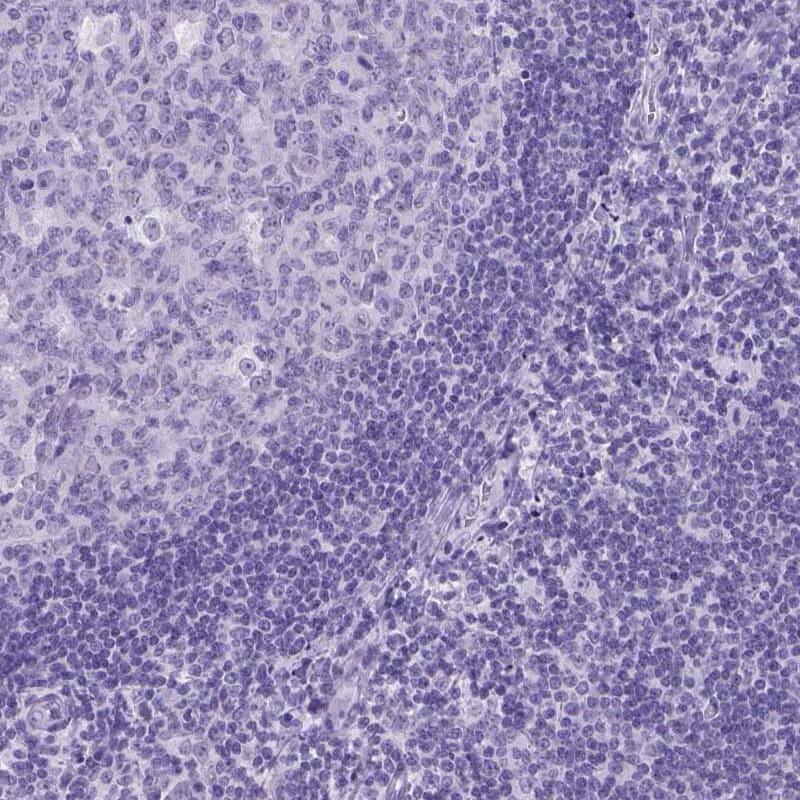 MARCH10 Antibody - BSA Free Immunohistochemistry-Paraffin: MARCH10 Antibody - BSA Free [NBP1-89833]
