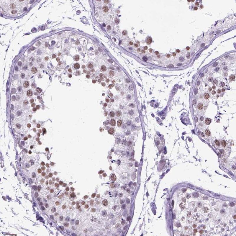 MARCH10 Antibody - BSA Free Immunohistochemistry-Paraffin: MARCH10 Antibody - BSA Free [NBP1-89833]