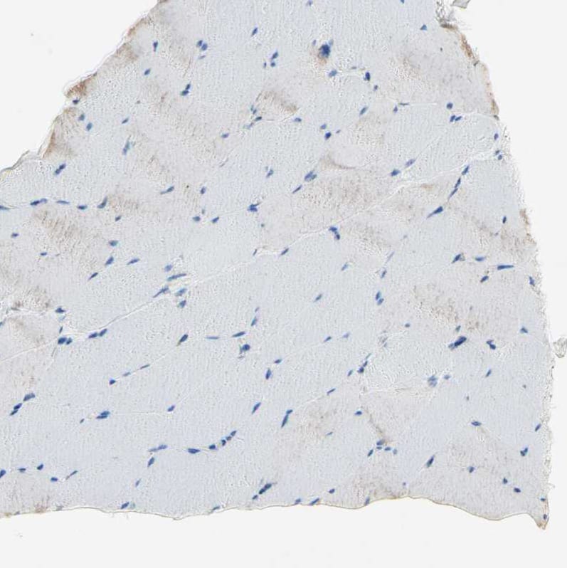 IKB zeta Antibody - BSA Free Immunohistochemistry-Paraffin: IKB zeta Antibody - BSA Free [NBP1-89835]
