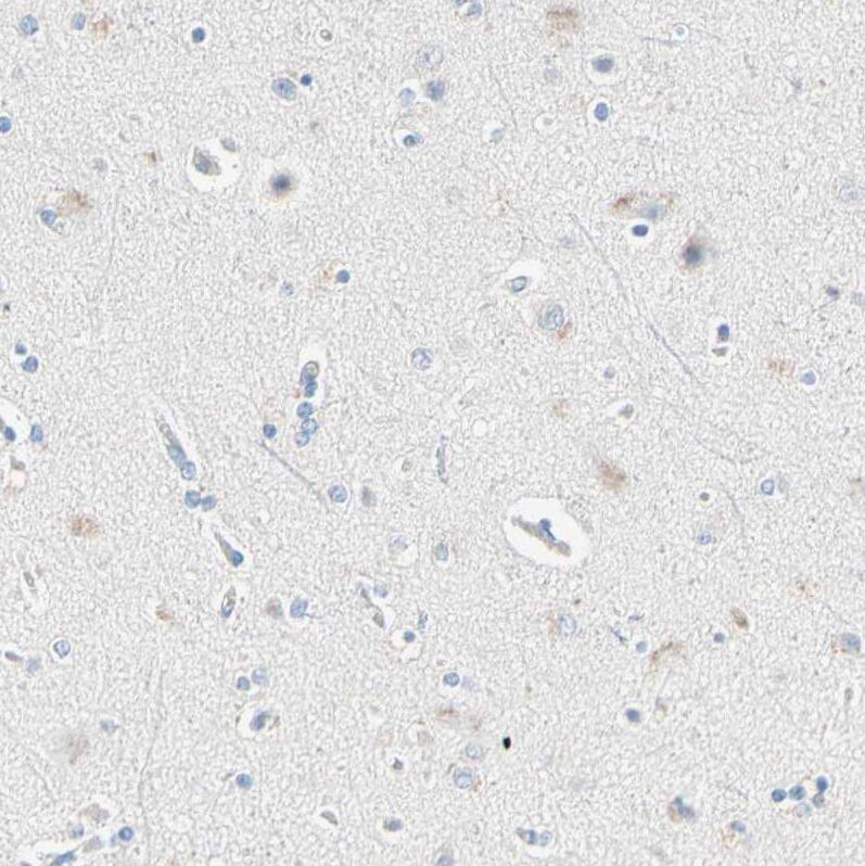 IKB zeta Antibody - BSA Free Immunohistochemistry-Paraffin: IKB zeta Antibody - BSA Free [NBP1-89835]