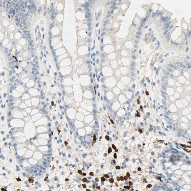 IKB zeta Antibody - BSA Free Immunohistochemistry-Paraffin: IKB zeta Antibody - BSA Free [NBP1-89835]