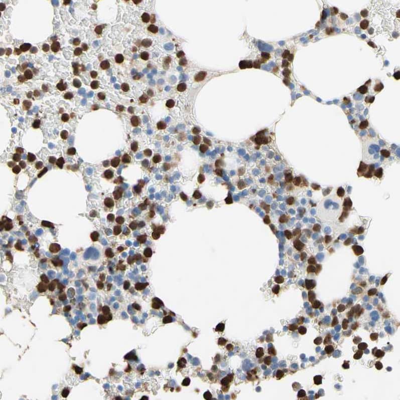 IKB zeta Antibody - BSA Free Immunohistochemistry-Paraffin: IKB zeta Antibody - BSA Free [NBP1-89835]