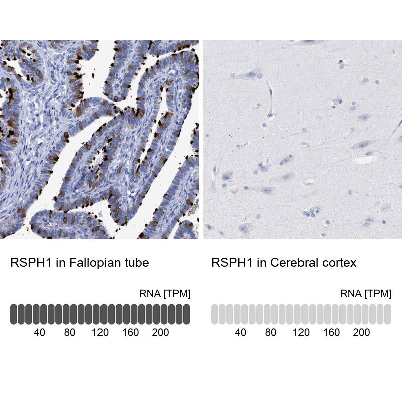 TSGA2 Antibody - BSA Free Immunohistochemistry-Paraffin: TSGA2 Antibody - BSA Free [NBP1-89839]