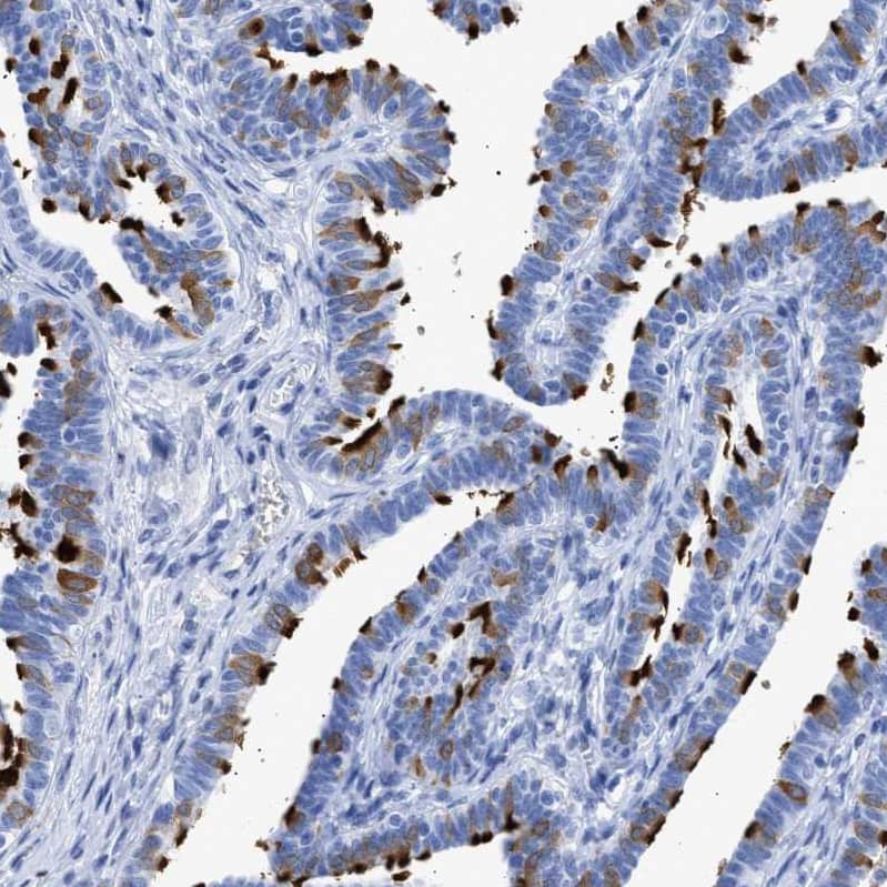 TSGA2 Antibody - BSA Free Immunohistochemistry-Paraffin: TSGA2 Antibody - BSA Free [NBP1-89840]