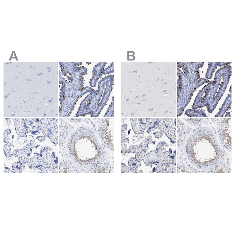 TSGA2 Antibody - BSA Free Immunohistochemistry-Paraffin: TSGA2 Antibody - BSA Free [NBP1-89840]
