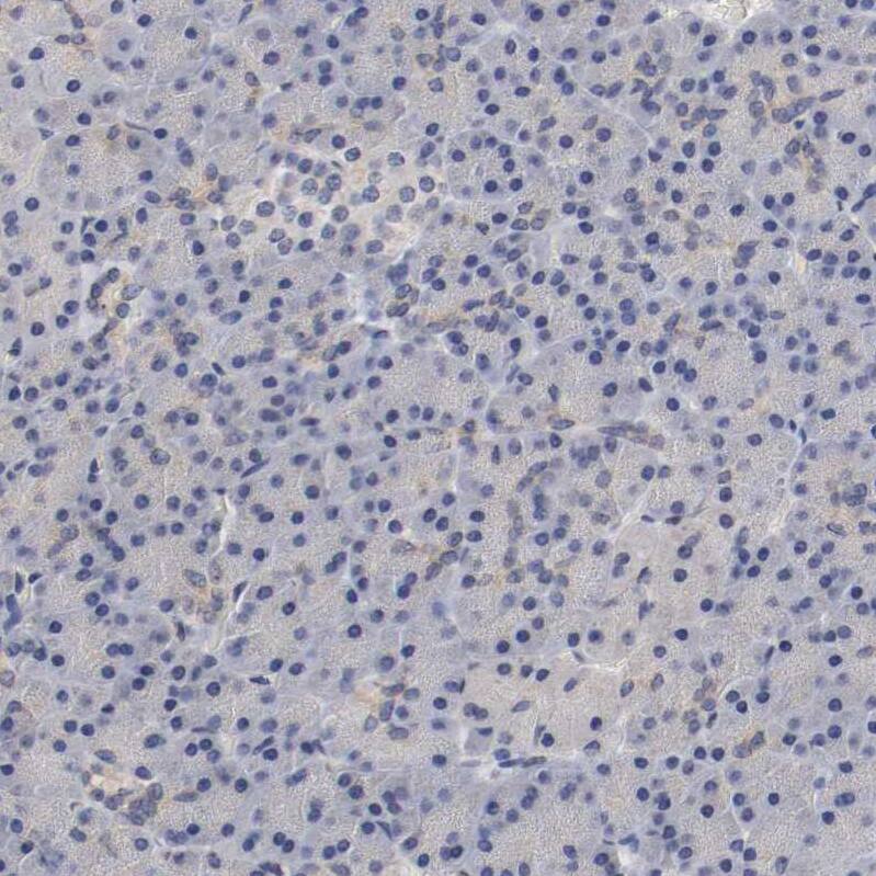FRA2 Antibody - BSA Free Immunohistochemistry-Paraffin: FRA2 Antibody - BSA Free [NBP1-89842]