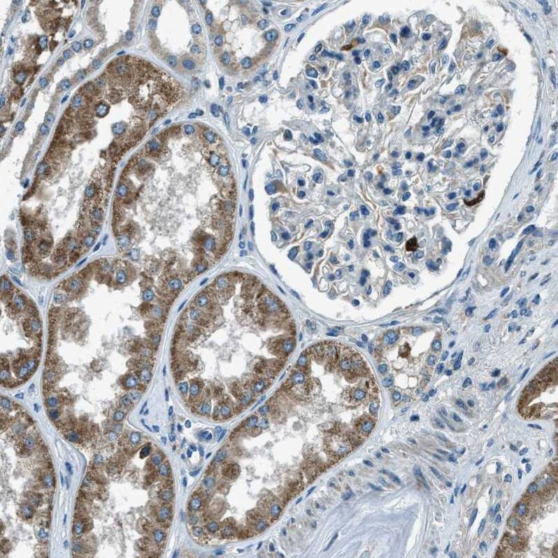 FAR1 Antibody - BSA Free Immunohistochemistry-Paraffin: FAR1 Antibody - BSA Free [NBP1-89847]