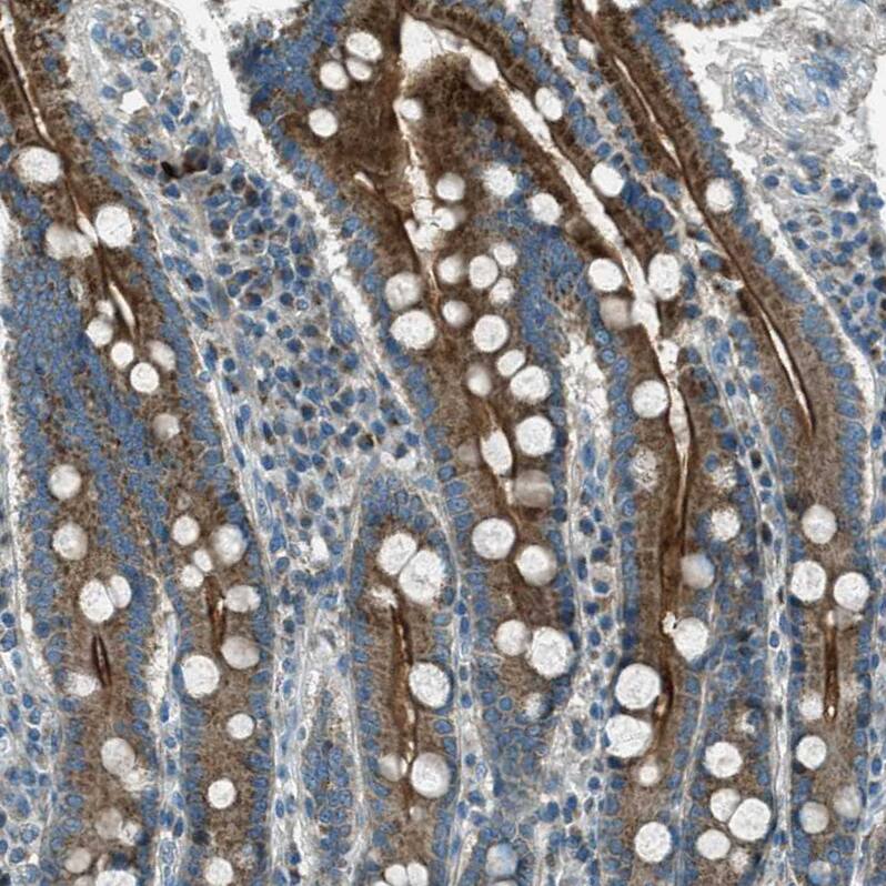 FAR1 Antibody - BSA Free Immunohistochemistry-Paraffin: FAR1 Antibody - BSA Free [NBP1-89847]
