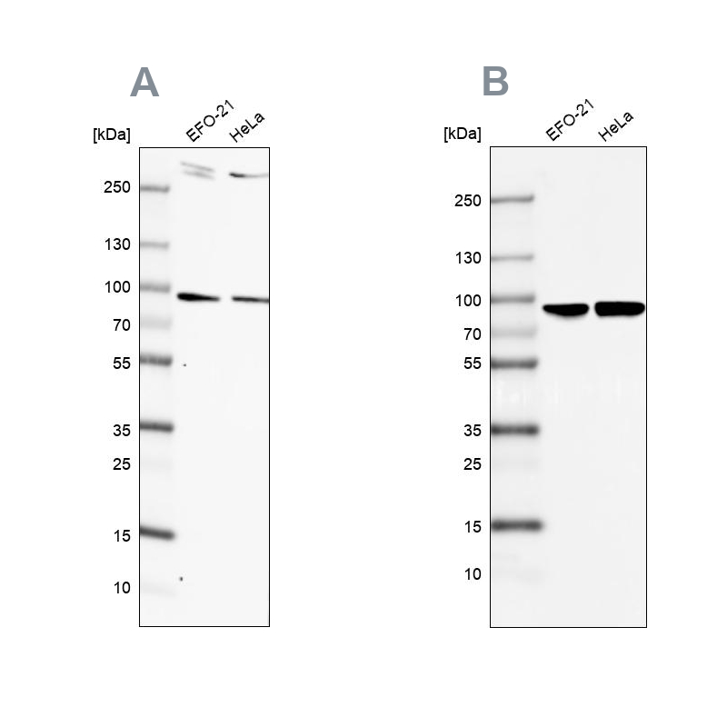 FLJ21908 Antibody - BSA Free Western Blot: FLJ21908 Antibody - BSA Free [NBP1-89849]