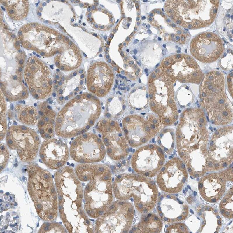 GPI7 Antibody - BSA Free Immunohistochemistry-Paraffin: GPI7 Antibody - BSA Free [NBP1-89853]