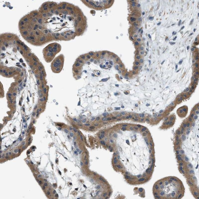 GPI7 Antibody - BSA Free Immunohistochemistry-Paraffin: GPI7 Antibody - BSA Free [NBP1-89853]