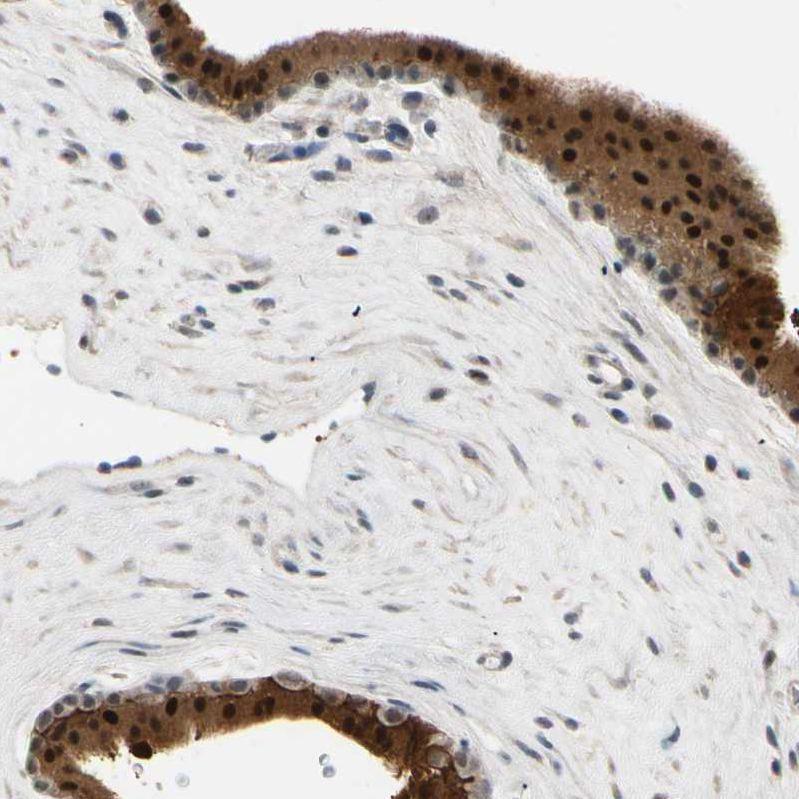 MINA Antibody - BSA Free Immunohistochemistry-Paraffin: MINA Antibody - BSA Free [NBP1-89863]