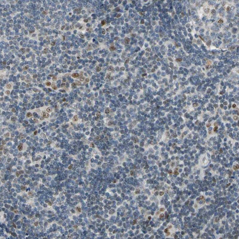 MINA Antibody - BSA Free Immunohistochemistry-Paraffin: MINA Antibody - BSA Free [NBP1-89863]