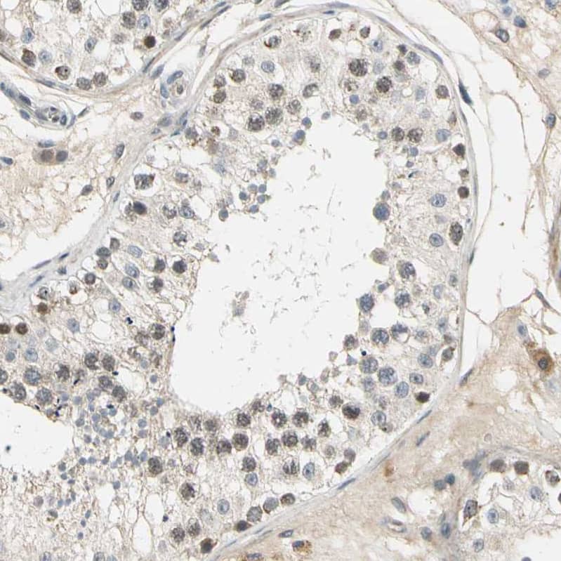 MINA Antibody - BSA Free Immunohistochemistry-Paraffin: MINA Antibody - BSA Free [NBP1-89863]