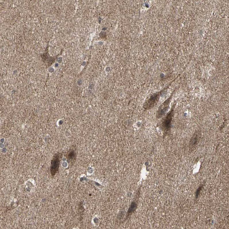 TAO Kinase 1 Antibody - BSA Free Immunohistochemistry-Paraffin: TAO Kinase 1 Antibody - BSA Free [NBP1-89864]