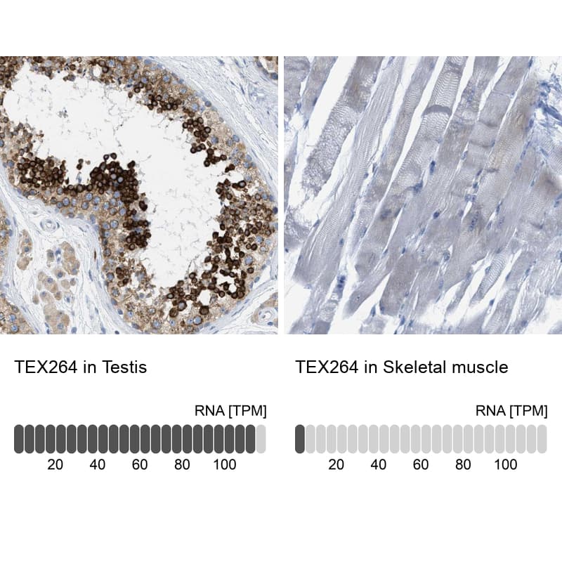 Testis expressed 264 Antibody - BSA Free Immunohistochemistry-Paraffin: Testis expressed 264 Antibody - BSA Free [NBP1-89866]