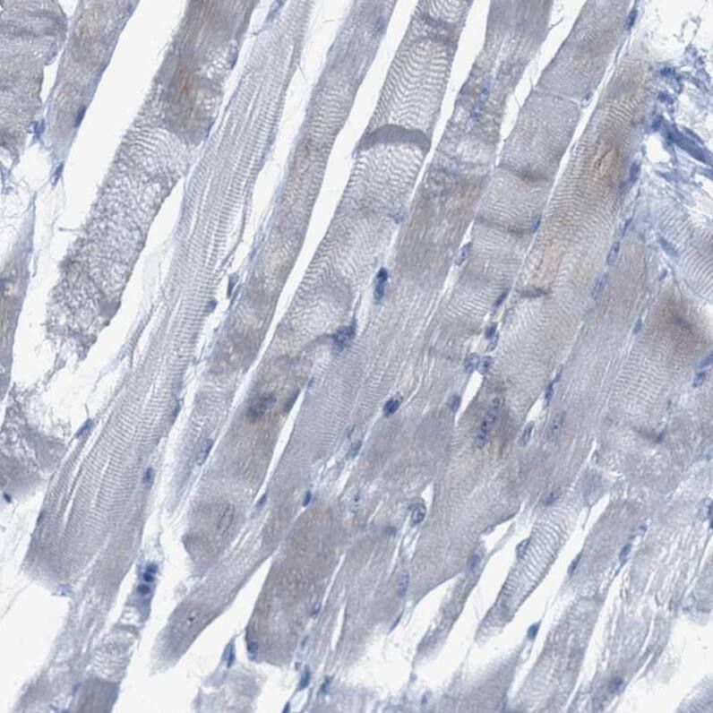 Testis expressed 264 Antibody - BSA Free Immunohistochemistry-Paraffin: Testis expressed 264 Antibody - BSA Free [NBP1-89866]