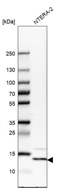 YBEY Antibody - BSA Free Western Blot: YBEY Antibody - BSA Free [NBP1-89876]