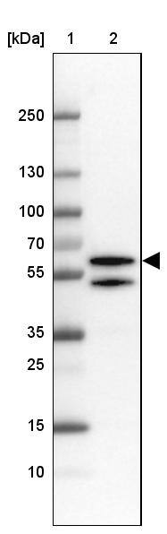 TBLR1 Antibody - BSA Free Western Blot: TBLR1 Antibody - BSA Free [NBP1-89880]
