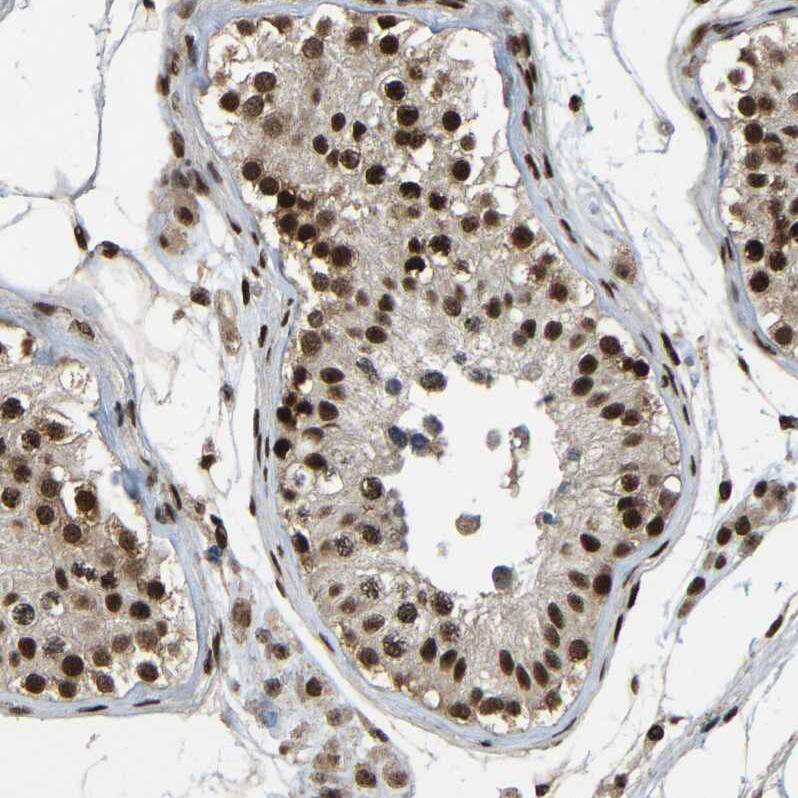 TBLR1 Antibody - BSA Free Immunohistochemistry-Paraffin: TBLR1 Antibody - BSA Free [NBP1-89880]