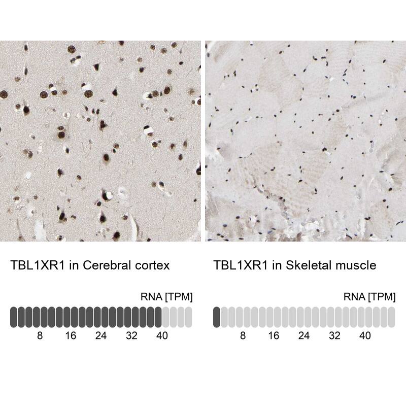 TBLR1 Antibody - BSA Free Immunohistochemistry-Paraffin: TBLR1 Antibody - BSA Free [NBP1-89880]