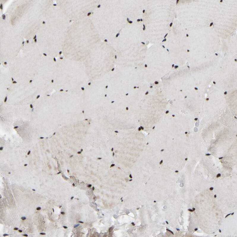 TBLR1 Antibody - BSA Free Immunohistochemistry-Paraffin: TBLR1 Antibody - BSA Free [NBP1-89880]