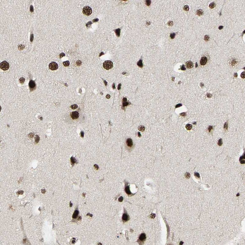 TBLR1 Antibody - BSA Free Immunohistochemistry-Paraffin: TBLR1 Antibody - BSA Free [NBP1-89880]