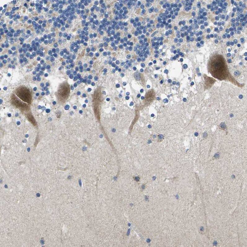 ERGI3 Antibody - BSA Free Immunohistochemistry-Paraffin: ERGI3 Antibody - BSA Free [NBP1-89881]