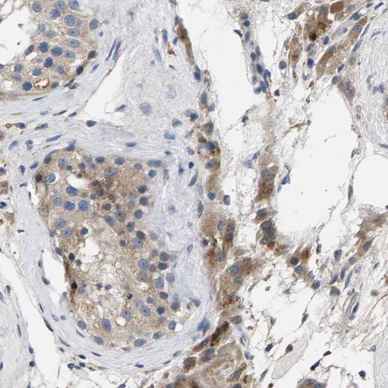 ERGI3 Antibody - BSA Free Immunohistochemistry-Paraffin: ERGI3 Antibody - BSA Free [NBP1-89881]