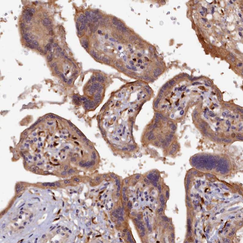 Kindlin Antibody - BSA Free Immunohistochemistry-Paraffin: Kindlin Antibody - BSA Free [NBP1-89883]