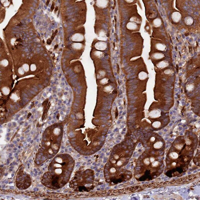 Kindlin Antibody - BSA Free Immunohistochemistry-Paraffin: Kindlin Antibody - BSA Free [NBP1-89883]