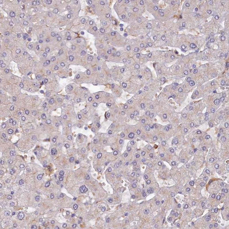 Kindlin Antibody - BSA Free Immunohistochemistry-Paraffin: Kindlin Antibody - BSA Free [NBP1-89883]