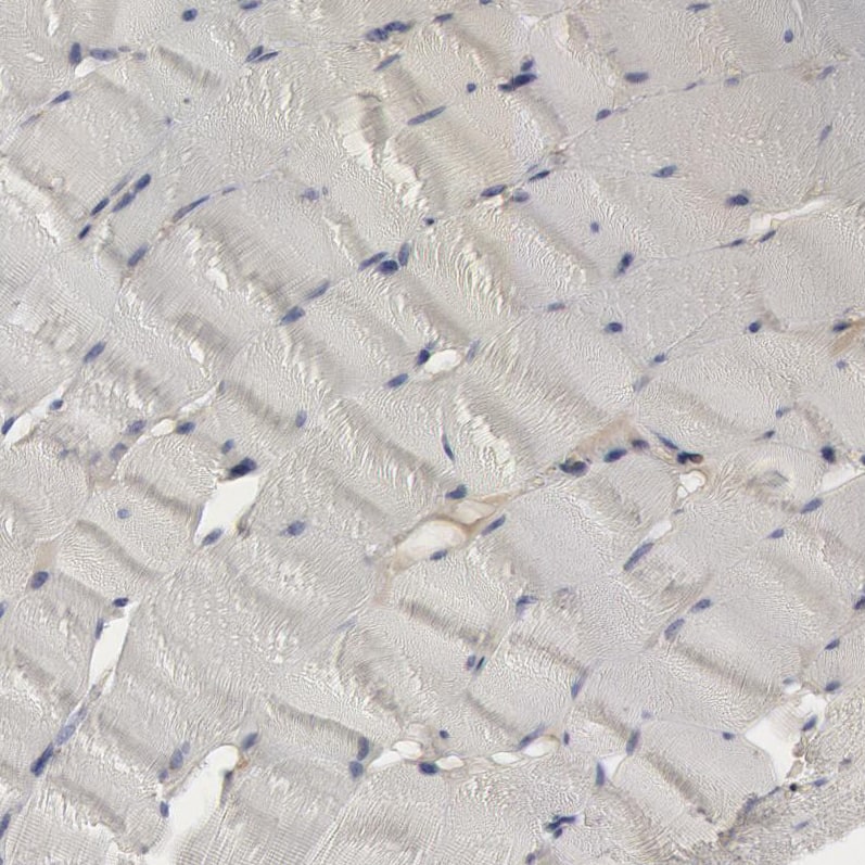 Complement Component C1qC Antibody - BSA Free Immunohistochemistry-Paraffin: Complement Component C1qC Antibody [NBP1-89885]