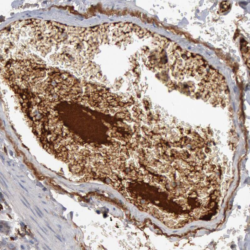 Complement Component C1qC Antibody - BSA Free Immunohistochemistry-Paraffin: Complement Component C1qC Antibody - BSA Free [NBP1-89885]
