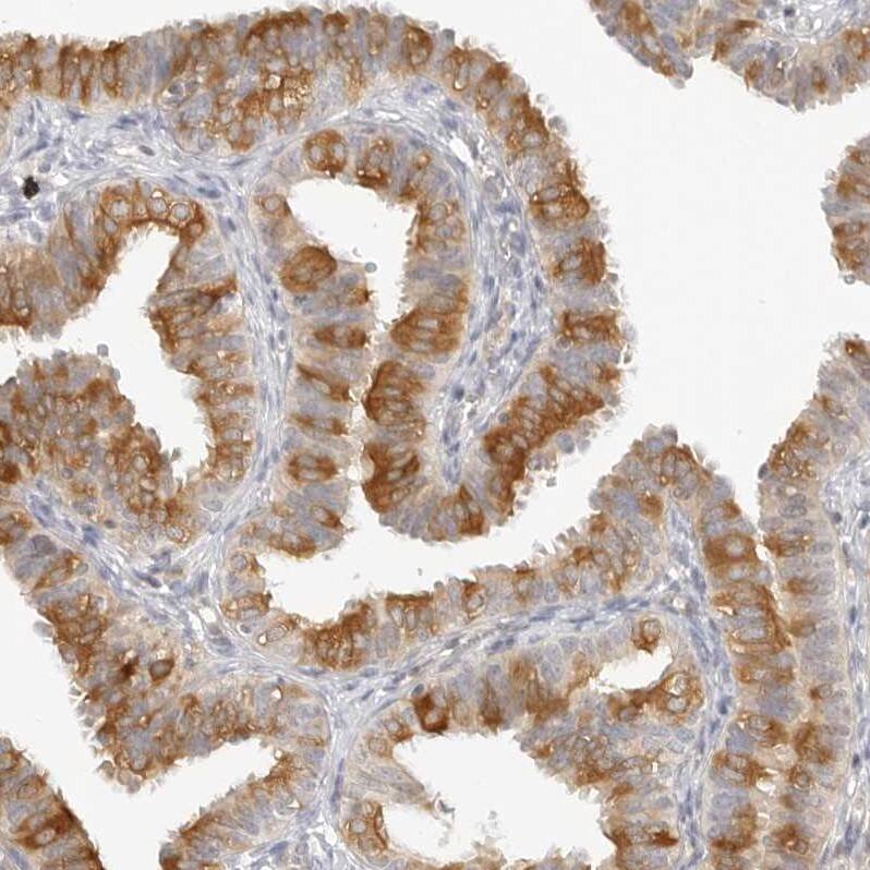 NOR1/OSCP1 Antibody - BSA Free Immunohistochemistry-Paraffin: NOR1/OSCP1 Antibody - BSA Free [NBP1-89889]
