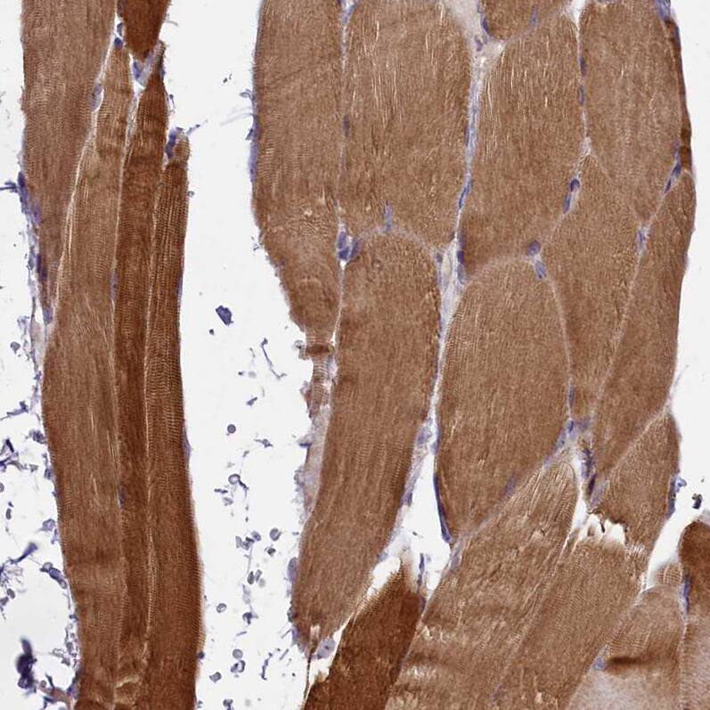 GLXR5 Antibody - BSA Free Immunohistochemistry-Paraffin: GLXR5 Antibody - BSA Free [NBP1-89897]