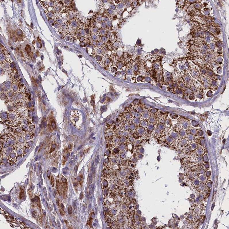 GLXR5 Antibody - BSA Free Immunohistochemistry-Paraffin: GLXR5 Antibody - BSA Free [NBP1-89897]