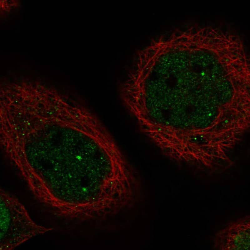 MTAC2D1 Antibody - BSA Free Immunocytochemistry/ Immunofluorescence: MTAC2D1 Antibody - BSA Free [NBP1-89900]