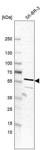 MTAC2D1 Antibody - BSA Free Western Blot: MTAC2D1 Antibody - BSA Free [NBP1-89900]