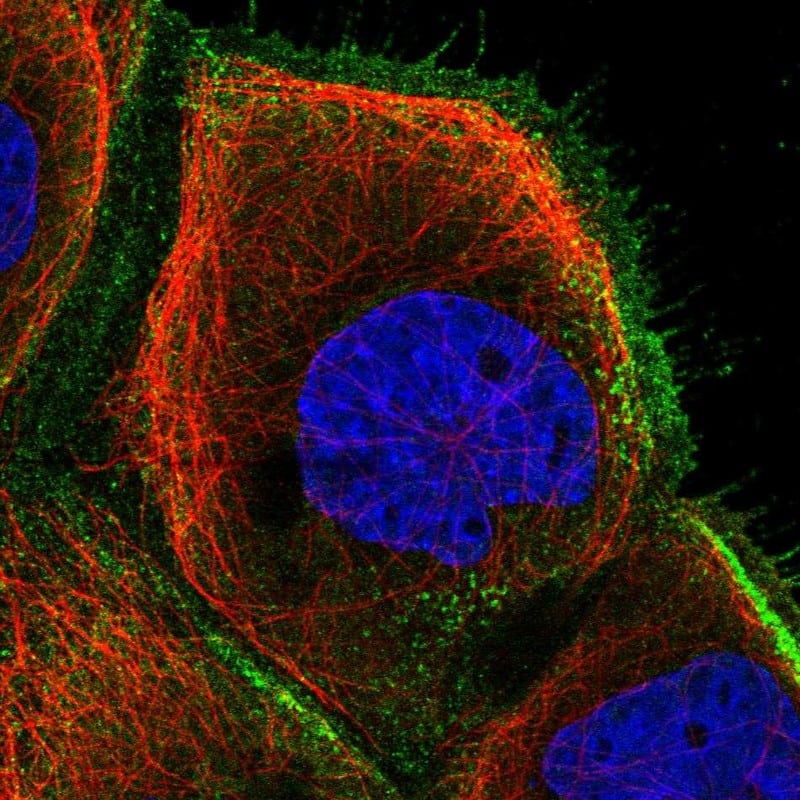 NY-REN-50 antigen Antibody - BSA Free Immunocytochemistry/ Immunofluorescence: NY-REN-50 antigen Antibody [NBP1-89903]