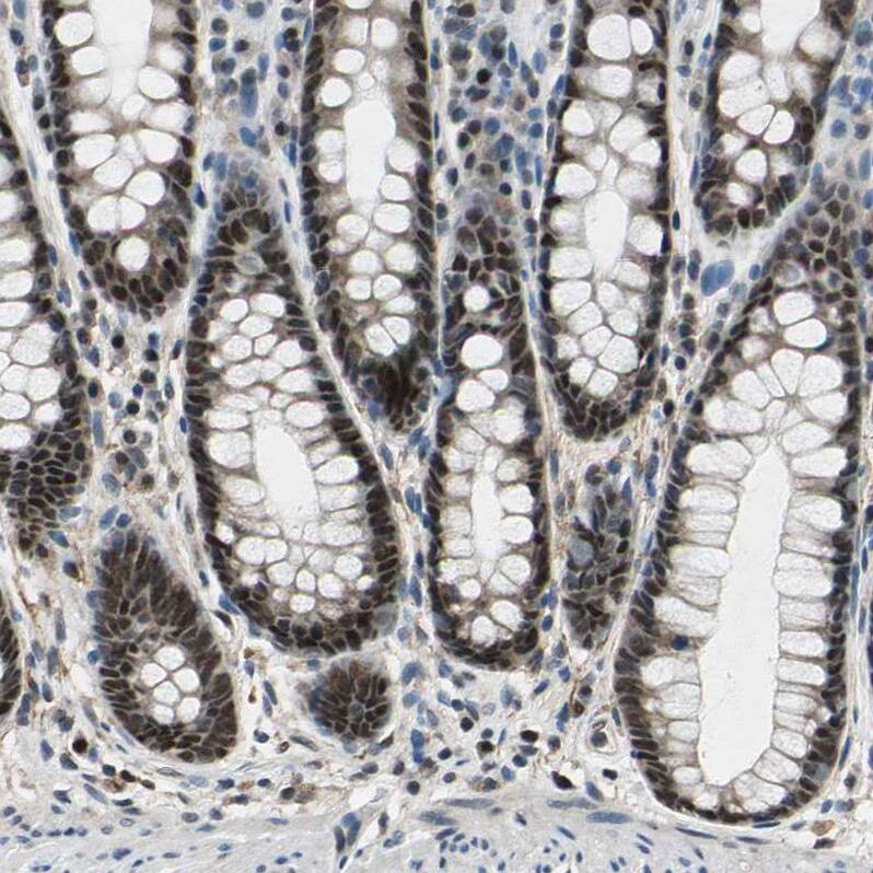 KNL-2 Antibody - BSA Free Immunohistochemistry-Paraffin: KNL-2 Antibody - BSA Free [NBP1-89905]