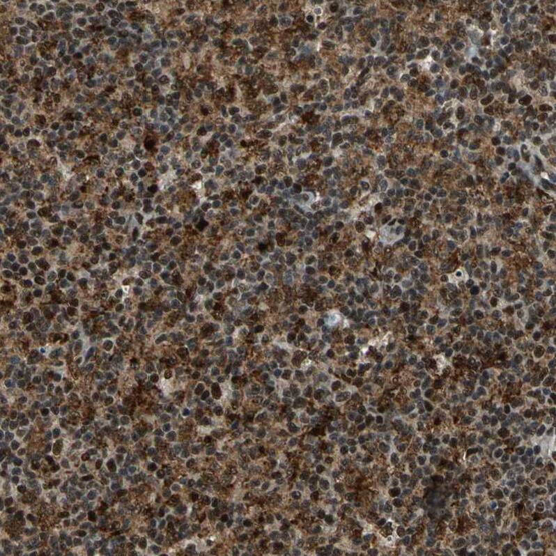 KNL-2 Antibody - BSA Free Immunohistochemistry-Paraffin: KNL-2 Antibody - BSA Free [NBP1-89905]