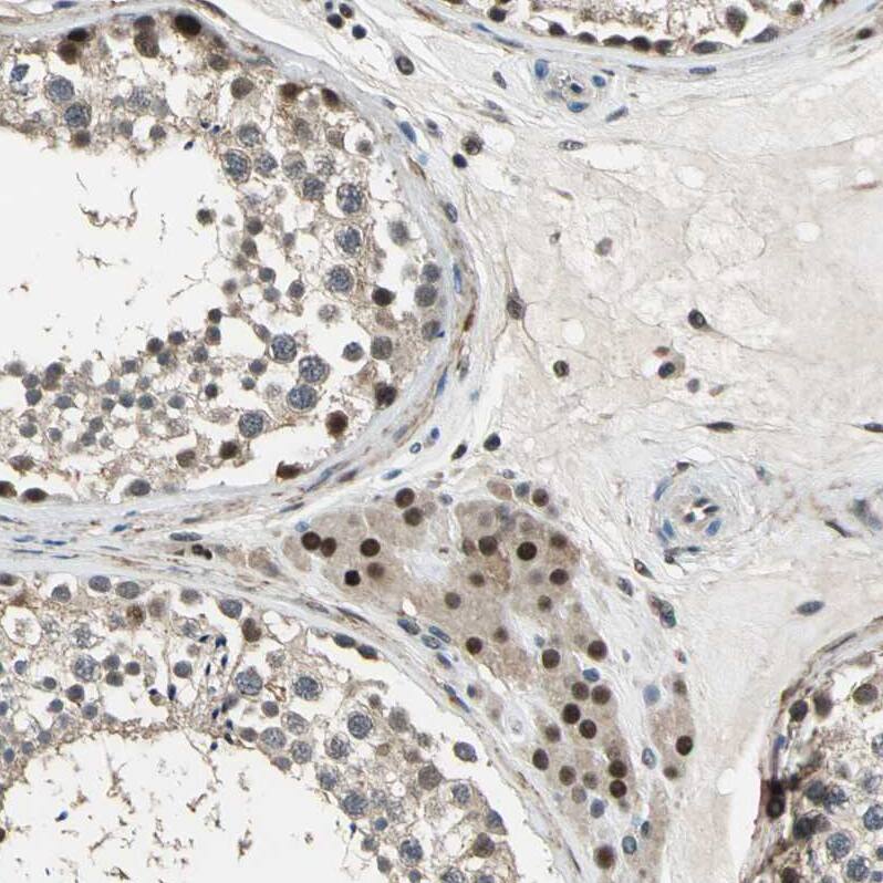 KNL-2 Antibody - BSA Free Immunohistochemistry-Paraffin: KNL-2 Antibody - BSA Free [NBP1-89905]