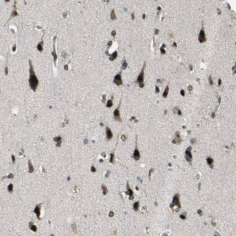 KNL-2 Antibody - BSA Free Immunohistochemistry-Paraffin: KNL-2 Antibody - BSA Free [NBP1-89905]