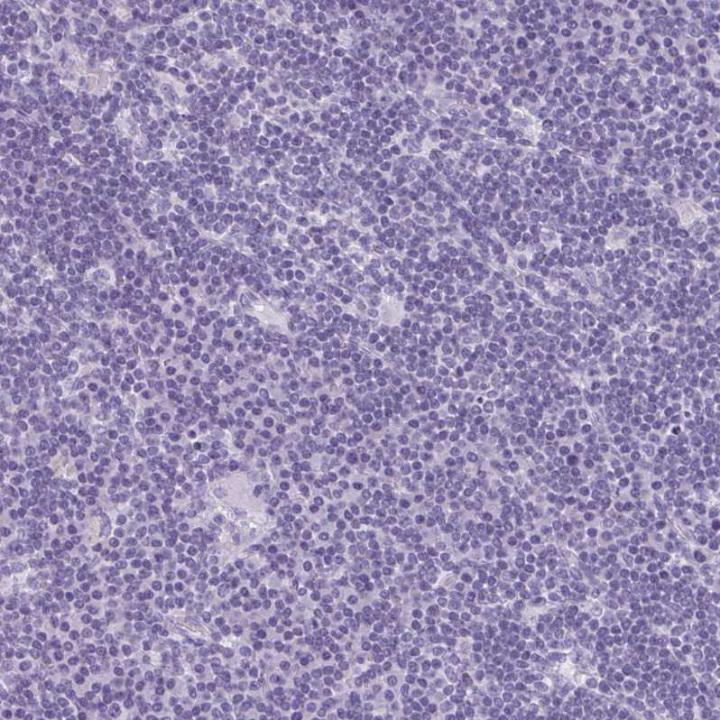 enkurin Antibody - BSA Free Immunohistochemistry-Paraffin: enkurin Antibody - BSA Free [NBP1-89911]